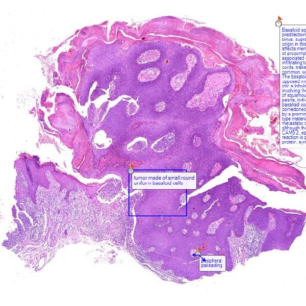 Find the Best quiz cases for MD pathology online services in Del