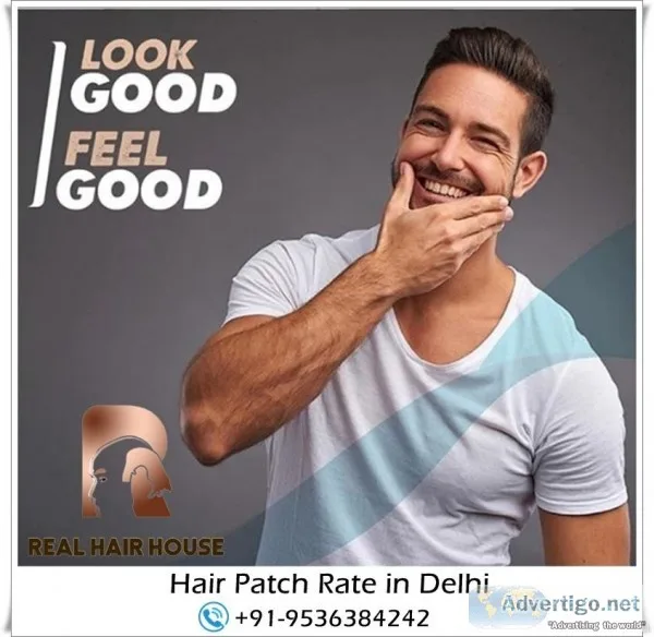Hair Patch in Delhi