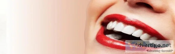 Teeth Whitening Singapore - Mirage Aesthetic
