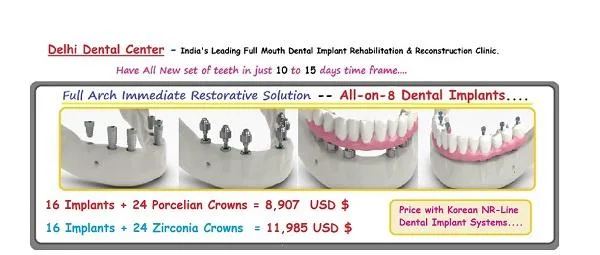 all-on-8 India  all-on-8 dental implants India