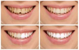 Oral Dental Implants Westwood