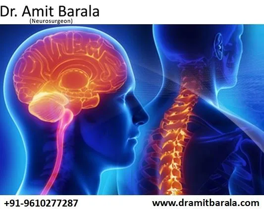 Best Neurologist in Jaipur