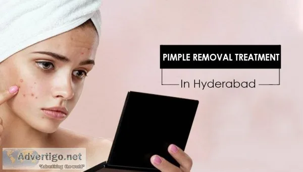 Pimple removal treatment in Hyderabad.