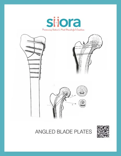 Angle blade plate proximal femur