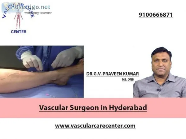 Vascular Surgeon in Hyderabad  Vascular Care Center