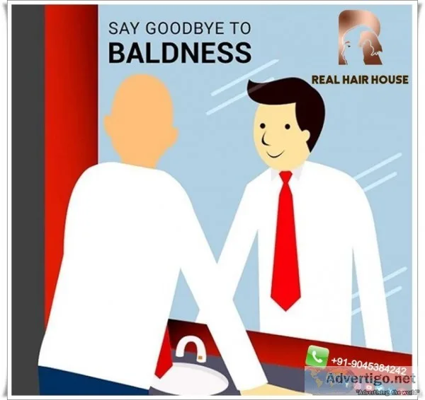 Hair Wigs in Delhi