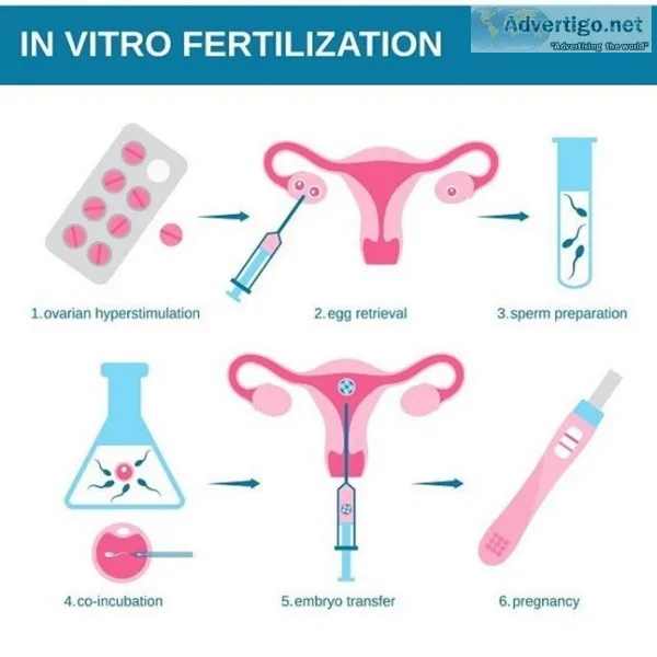 All you need to know about IVF (In Vitro fertilization)