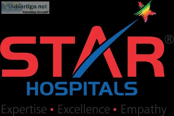 Best multi-speciality hospital in hyderabad | star hospitals