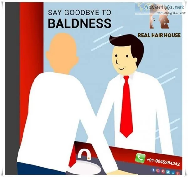 Hair Patch in Gurgaon