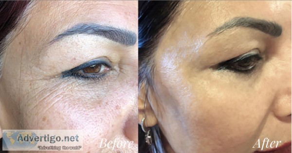 Blue scorpion venom skincare