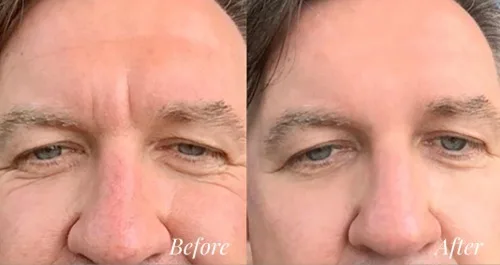 Marvelous skin care containing blue scoprion peptide