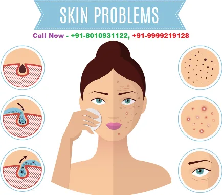 8010931122  Skin Specialist doctor in Dwarka Sector 9