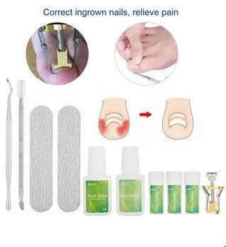 Buy Toenail Straightening Clip Curved Patch Nail Stickers Toe Re