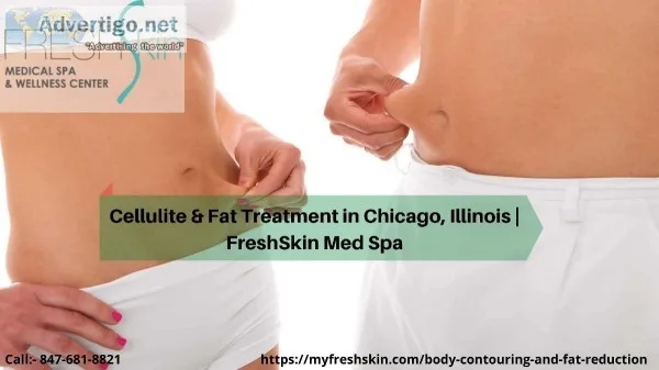 Cellulite and Fat Treatment in Chicago Illinois