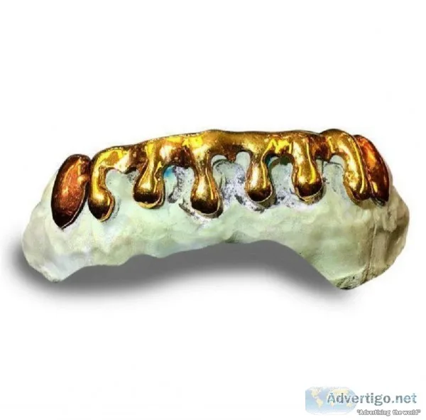 Premium Custom Gold Thick Drip Grillz Laviticus
