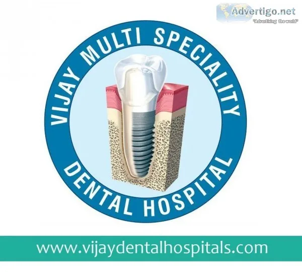 Endodontics  Root canal treatment Vijay dental hospital Dental c