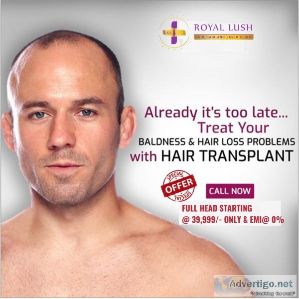 Treat your baldness and hair loss with hair transplant