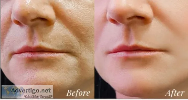 Blue scorpion anti-aging skin care