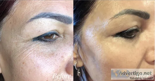 Blue scorpion anti-aging skin care