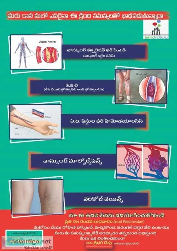 Ask dr devu aovarian vein syndrome symptoms bronchial artery emb