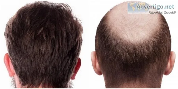About satya hair clinic - hair transplant doctors in delhi