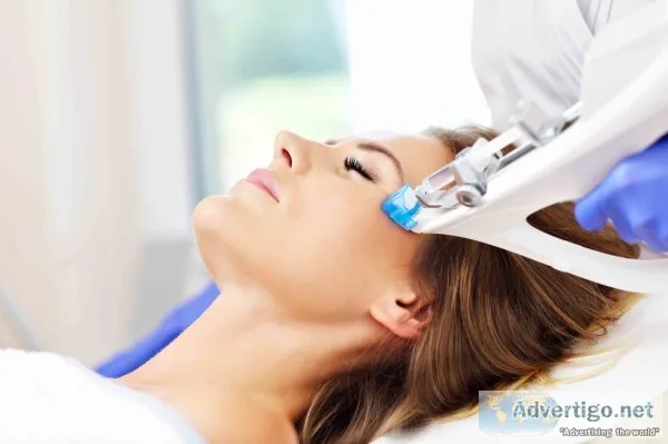 Mesotherapy for hair loss in delhi