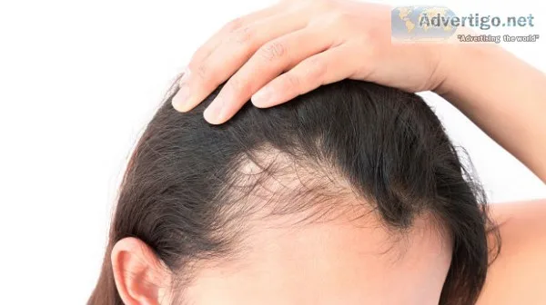 Best scarring alopecia treatment clinic in delhi