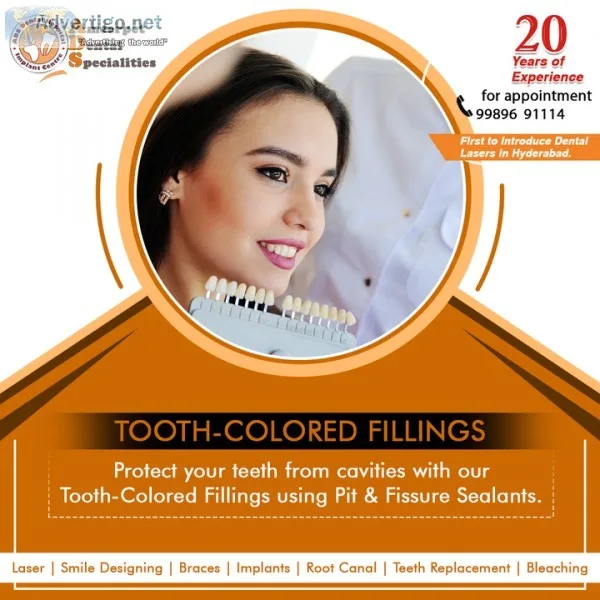 Tooth Filling Cost in Hyderabad - Tooth-Colored Fillings - ADS D