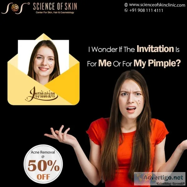 Best Acne Pimple Removal Treatment From Science Of Skin Clinic