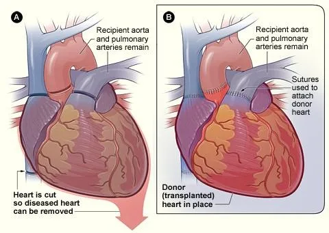 Cardiothoracic Surgeon Sacramento