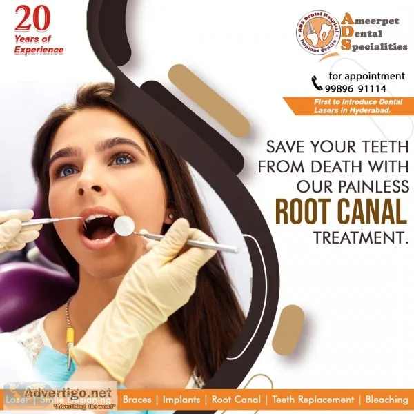 Root Canal Treatment and Cost in Hyderabad  Painless  ADS Dental