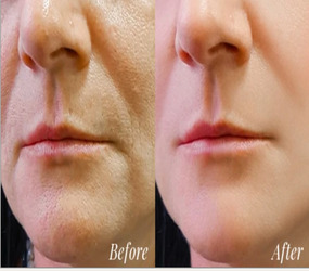 Restore your natural beauty this blue scorpion venom cream is am