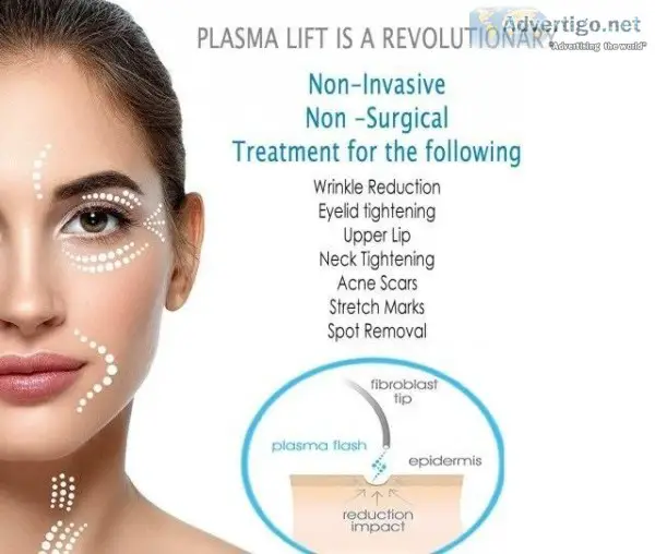 Fibroblast plasma face lift