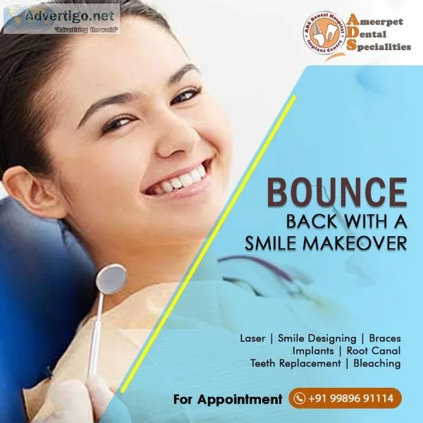 smile designing cost in Hyderabad - dental clinic in Hyderabad