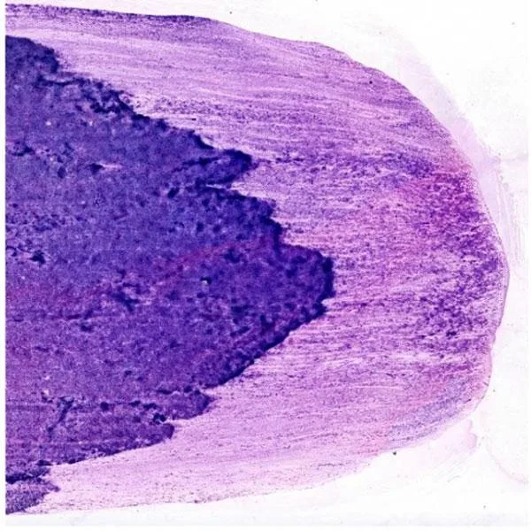 Cytology Slides