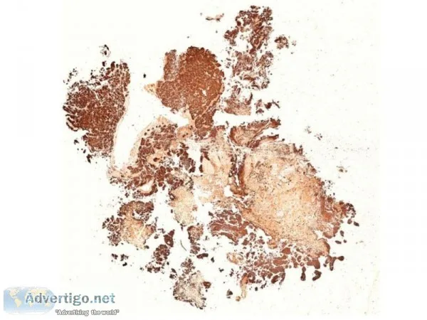 Virtual IHC slides