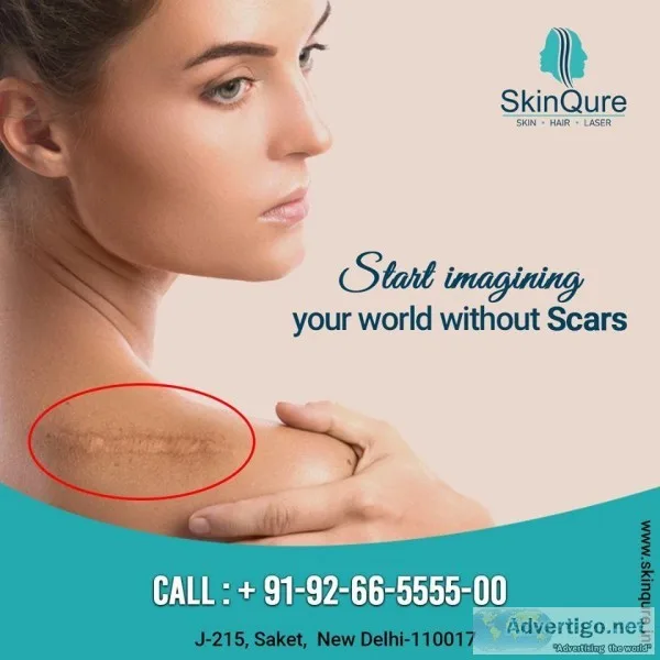 Best skin doctor in Delhi