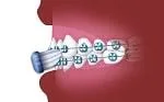 Orthodontist Macomb MI