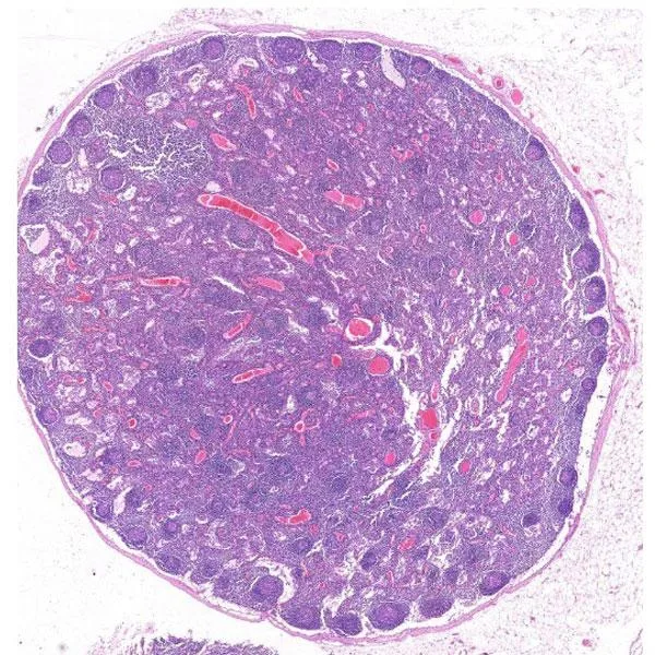 Digital Pathology slides