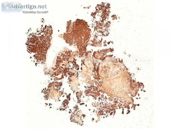 Virtual IHC slides