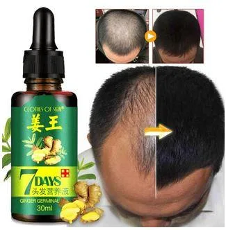 Ginger Germinal Oil Fast Hair Growth Anti-Hair Loss Serum