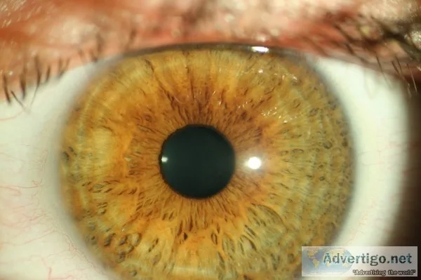 Iridology, pain relief naturopath - Dr. Scott