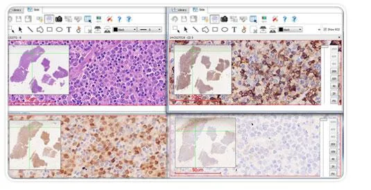 Virtual pathology slides