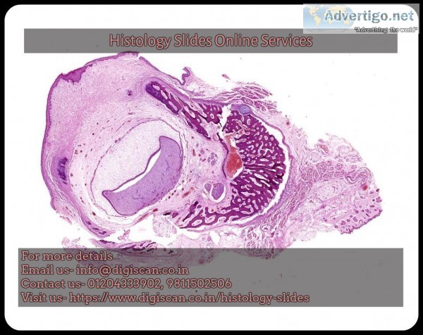 Histopathology slides