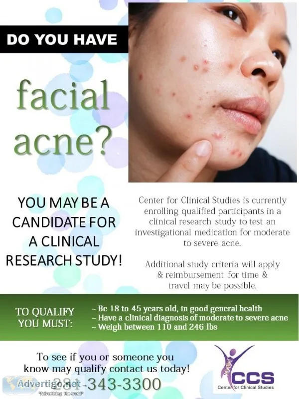Do you have acne  Are you 18 to 45