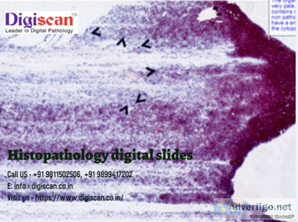 Histopathology slides