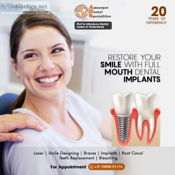 Dental Implant Cost in Hyderabad - Dental Implants in Hyderabad
