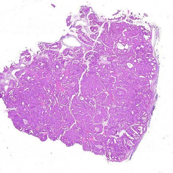Online Pathology quiz cases