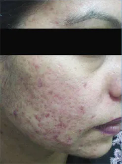Best dermatologist in vasant kunj, delhi | desmoderm