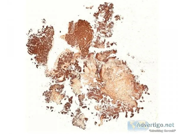 Virtual IHC slides